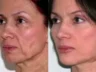 1596495118_coolaser_clinic_1-300x208